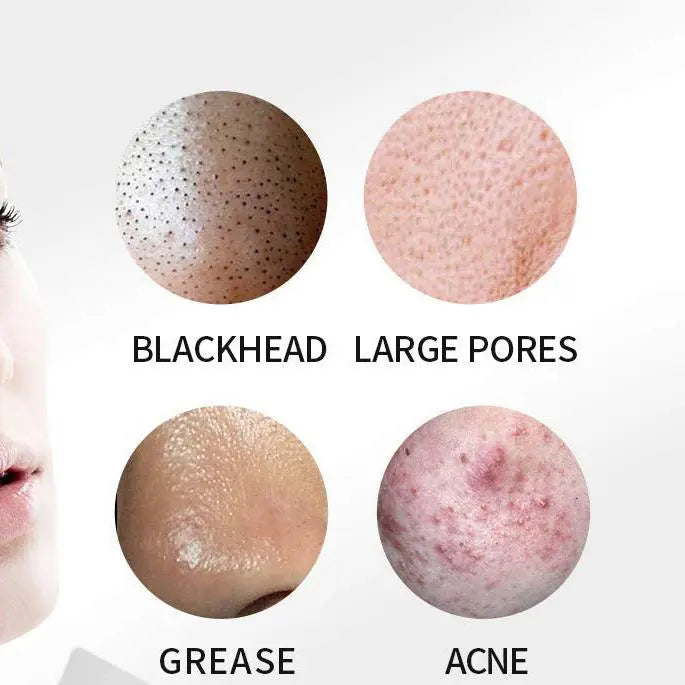 Ultrasonic Pore Cleaning Tool - LV B&B Shop