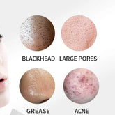 Ultrasonic Pore Cleaning Tool - LV B&B Shop